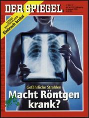 32/1993 Macht r�ntgen krank